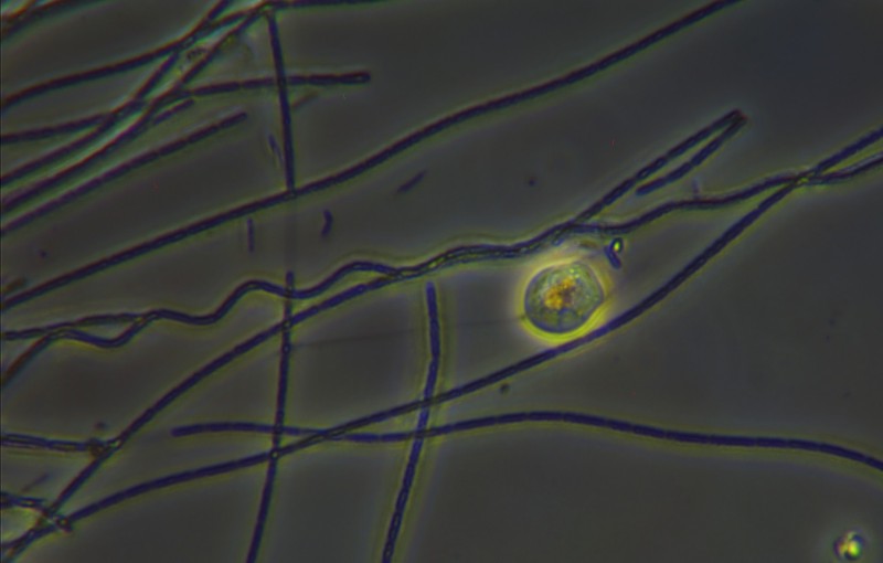 Vorticella e cianobatteri